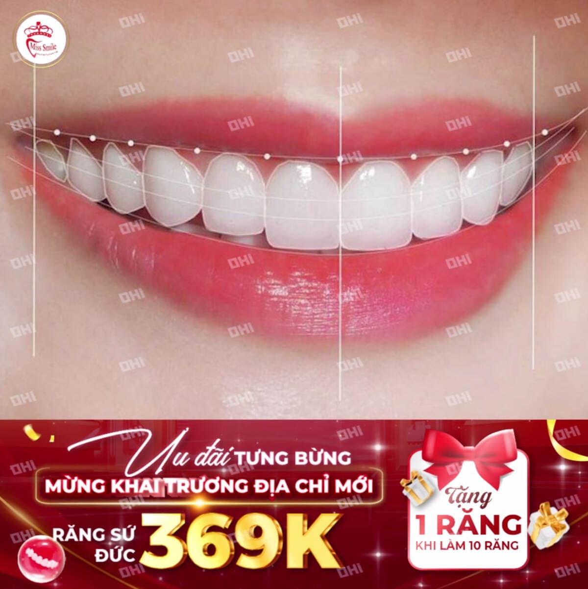 NHA KHOA MISS SMILE
