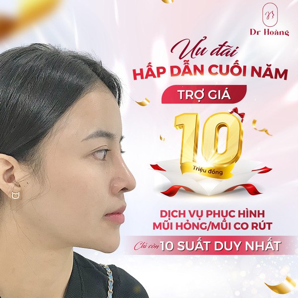 THẨM MỸ DR.HOÀNG - PHỤC HÌNH MŨI HỎNG