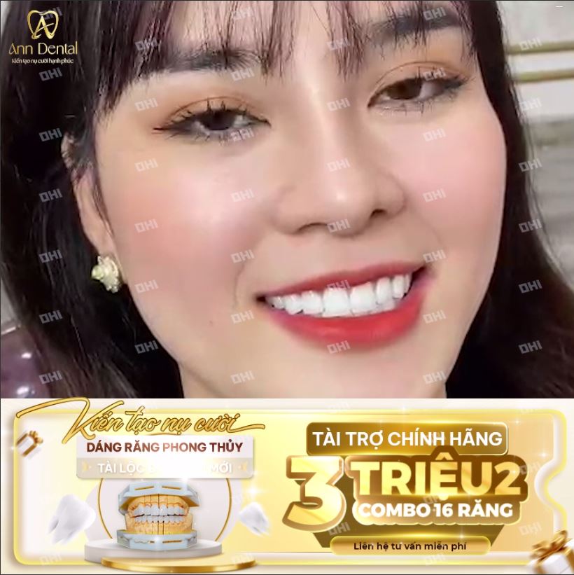 ANN DENTAL - GIỚI THIỆU ƯU ĐÃI