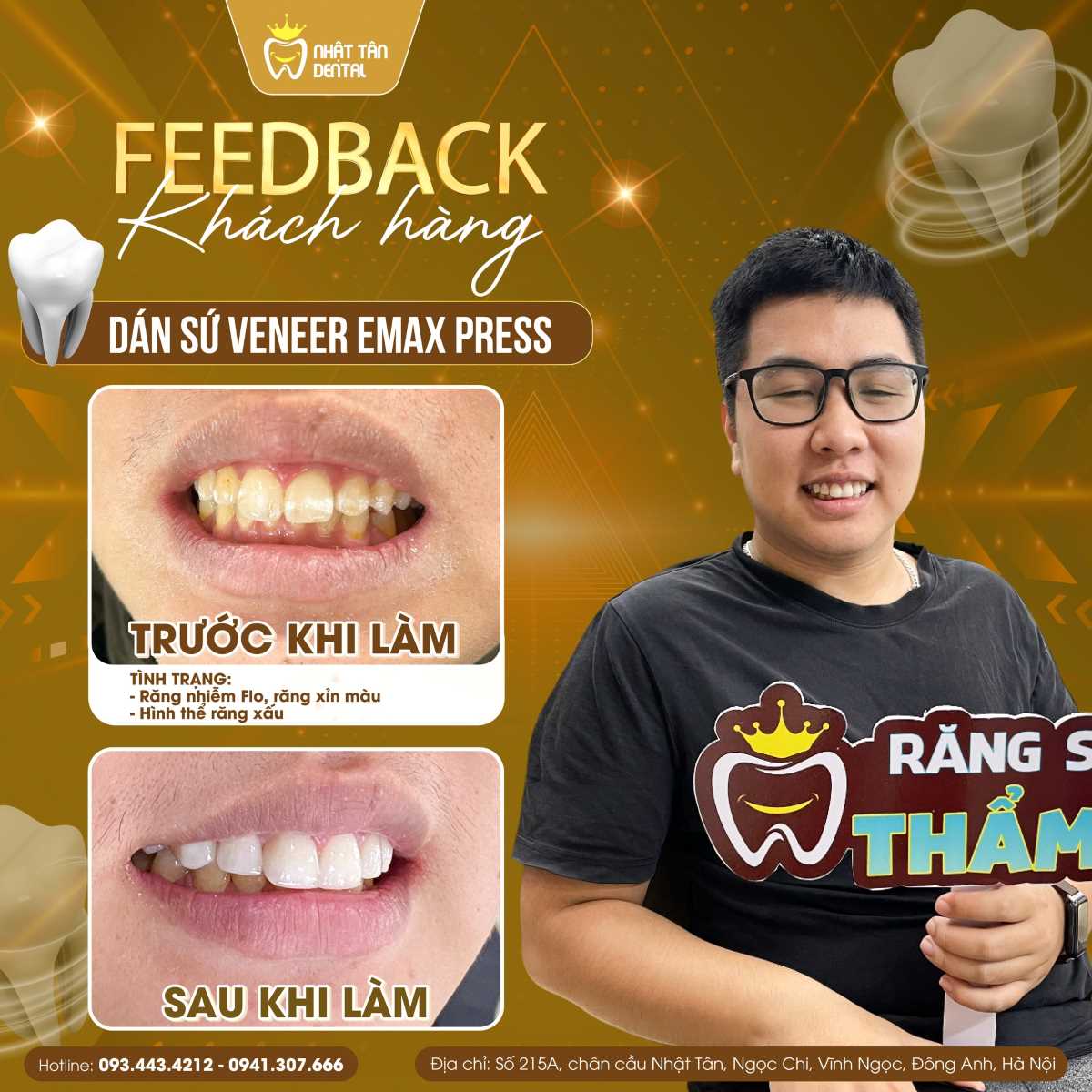 NHẬT TÂN DENTAL - GIỚI THIỆU ƯU ĐÃI