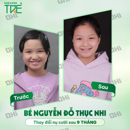 PHÒNG KHÁM NHA KHOA TRẺ - GIỚI THIỆU DỊCH VỤ